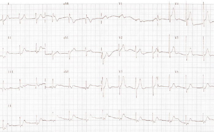 kjm-80-6-708-14f3.tif