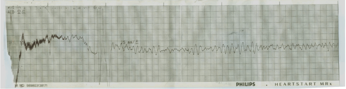 kjm-93-2-211f1.tif