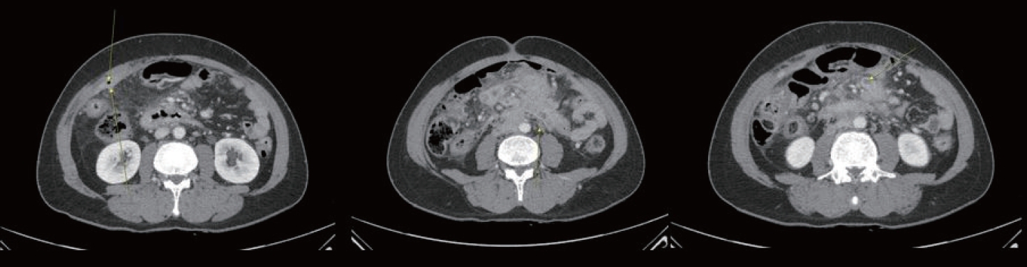Figure 11.