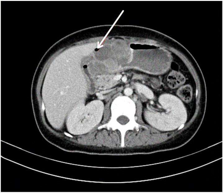 Figure 3.