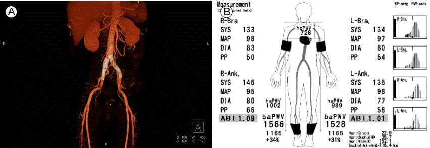 /upload/thumbnails/kjm-90-5-433f3.gif