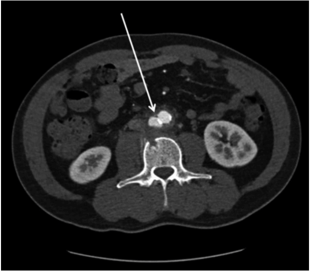 Figure 3.